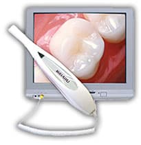 Intra oral camera