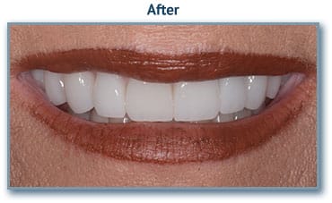 Cosmetic dentistry buford, ga