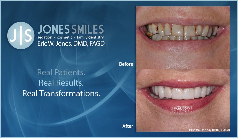 Get your smile back with dentist buford, ga