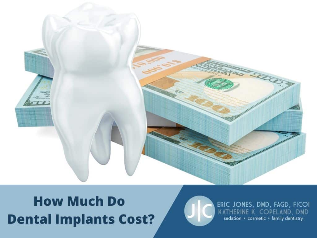 How Much Do Dental Implants Cost Jones Smiles