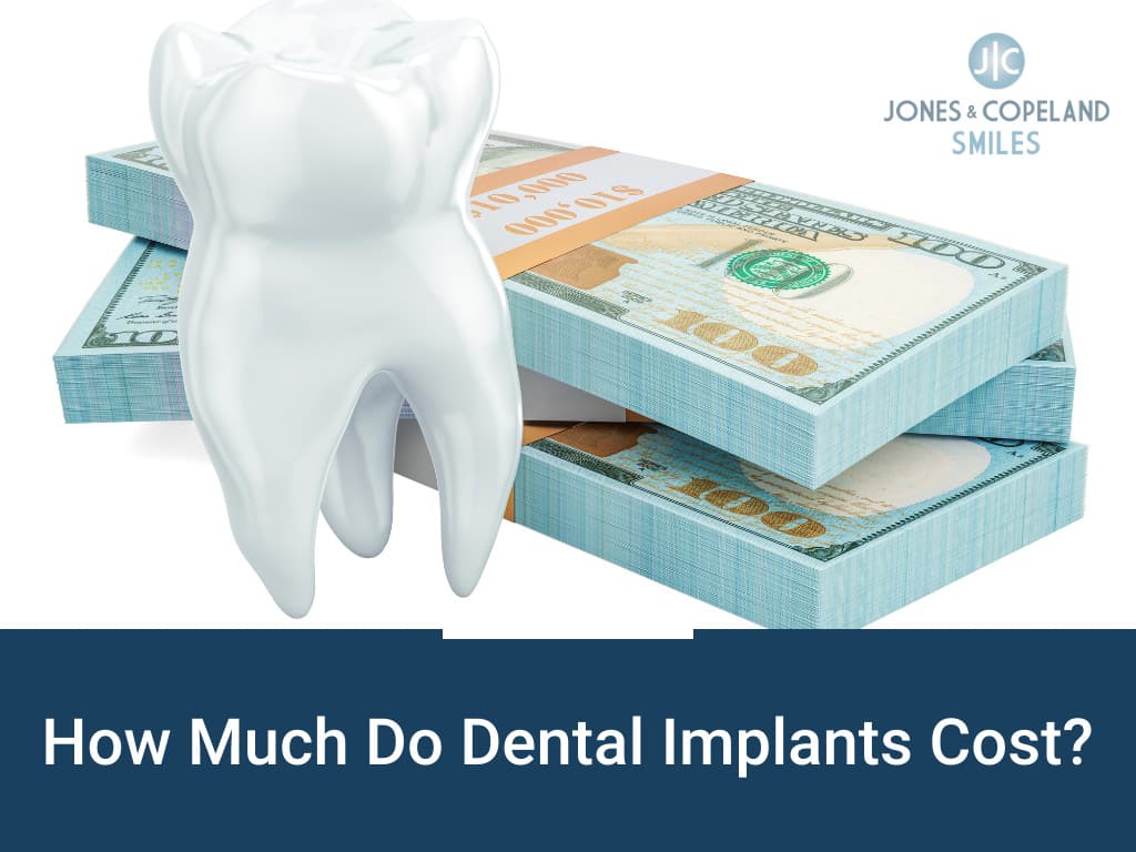 How much do dental implants cost