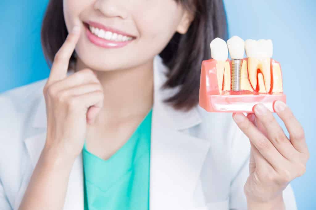 woman dentist holding dental implant tooth
