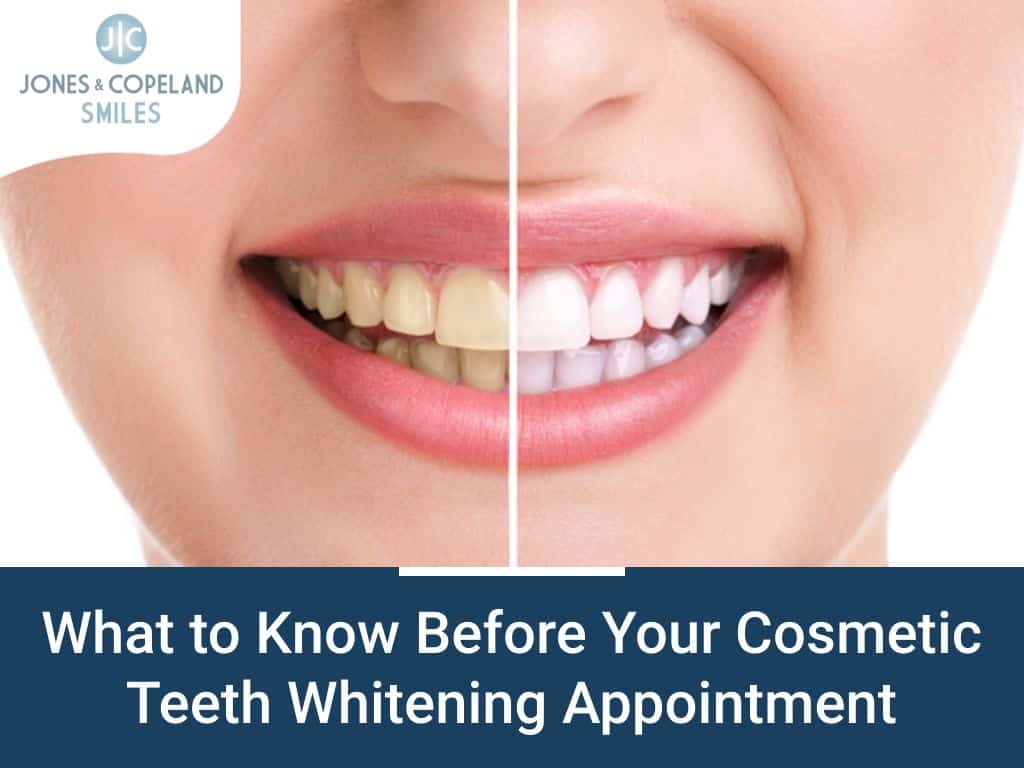 Know Before Cosmetic Teeth Whitening Appointment